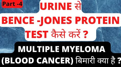 bence jones urine test bottle|bence jones myeloma prognosis.